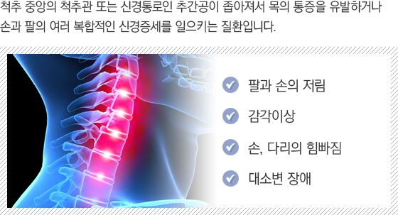 ���߰� ������