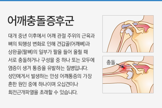 ����浹���ı�