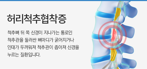 �㸮ô��������