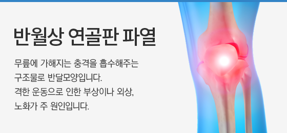 �ݿ��� ������ �Ŀ�