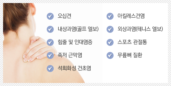 ü�� ����� ���� ��ȯ