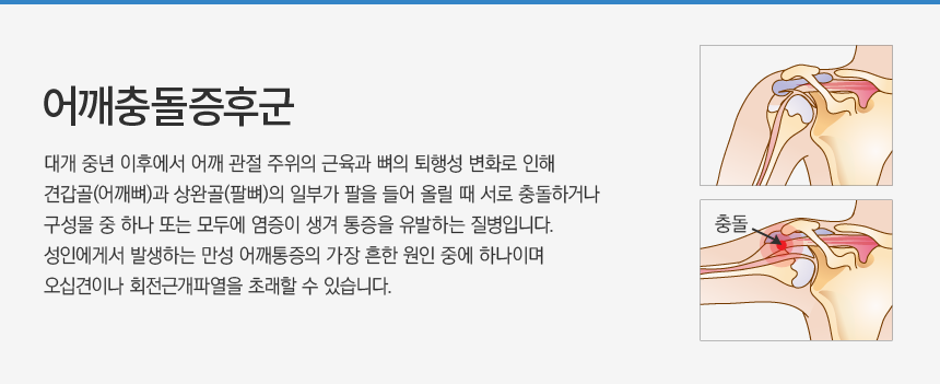 ����浹���ı�