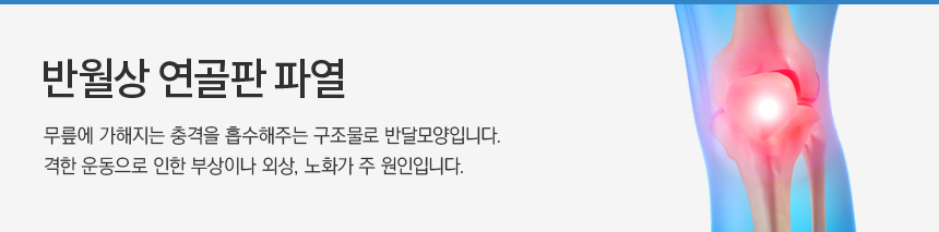 �ݿ��� ������ �Ŀ�