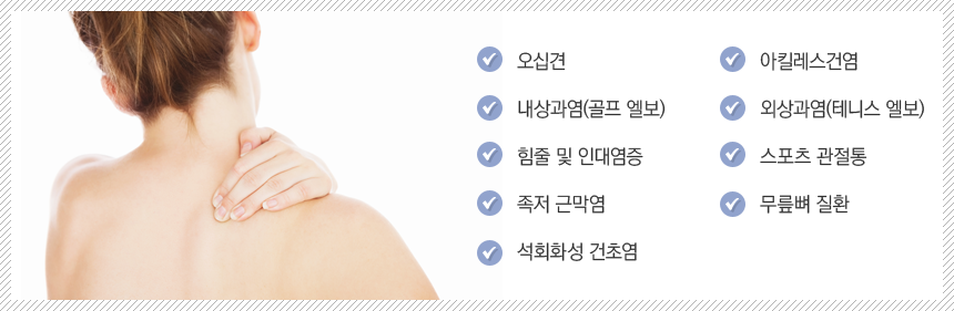 ü�� ����� ���� ��ȯ